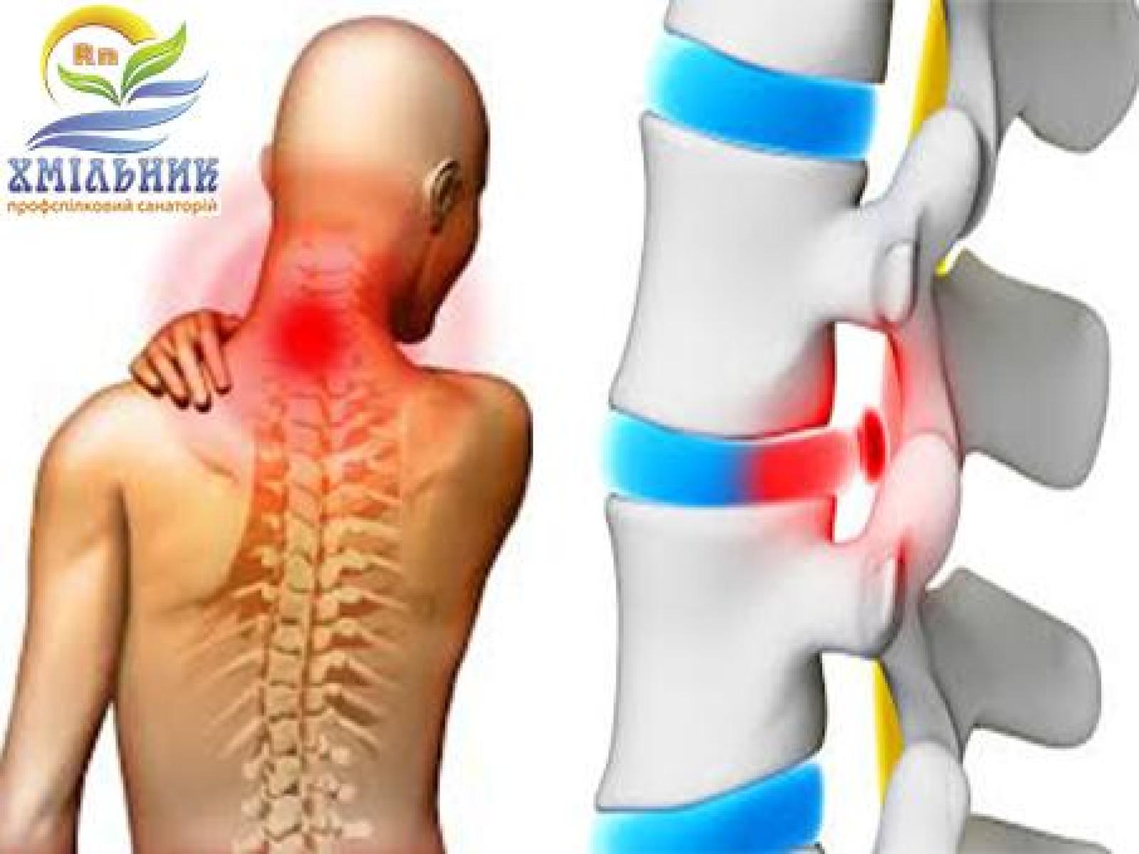 Лечение заболеваний опорно-двигательного аппарата.